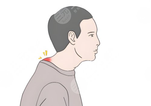 宿州市立医院韦元强富贵包技术怎么样