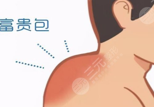 宿州市立医院韦元强富贵包技术怎么样