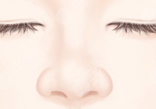 长沙华韩邓颖缩鼻翼技术可以吗