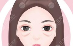 扬州第一人民医院去眼袋要多少钱？医院简介|价目标准附上！