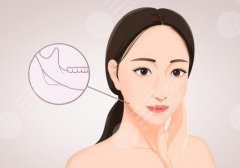 2025长沙磨骨医生有哪位？陈杰、陈铁夫等技术大牛更新！