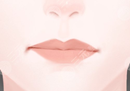 北医三院整形科唇部整形多少钱