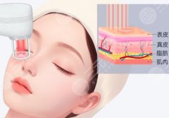 徐州中心医院点阵激光价格表一览，速看费用列表与科普资料分享