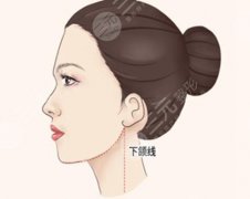 何晋龙磨骨怎么样？赶紧来看一看医生资料_磨骨特色优选