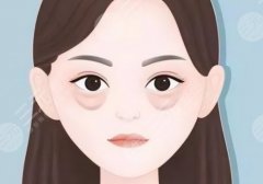 2025新华医院去眼袋多少钱?费用是从2000元起!医院实力在线、审美靠前! 2025新华医院去眼袋多少钱?费用是从2000元起!医院实力在线、审美靠前!
