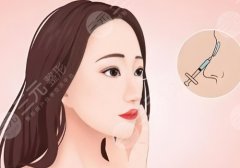 中国医学科学院整形外科医院鼻整形哪个大夫更擅长?宋涛、谢洋春、赵延勇等医生实力pk 中国医学科学院整形外科医院鼻整形哪个大夫更擅长?宋涛、谢洋春、赵延勇等医生实力pk