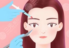 2025中国医学科学院整形外科医院做提眉手术费用!低至1500元起!公布医院信息、案例等 2025中国医学科学院整形外科医院做提眉手术费用!低至1500元起!公布医院信息、案例等