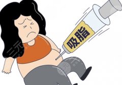 2025番禺区人民医院抽脂多少钱?低至5100万元!分析了医院信息、医生、案例等 2025番禺区人民医院抽脂多少钱?低至5100万元!分析了医院信息、医生、案例等