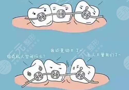 天津市口腔医院牙齿矫正费用