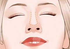 空军总医院做鼻子怎么样？技术强，审美好，案例十分丰富