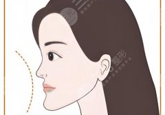 2025北京世纪坛医院正颌手术费用!2万元起!院内实力很强、多位医生进行坐诊 2025北京世纪坛医院正颌手术费用!2万元起!院内实力很强、多位医生进行坐诊