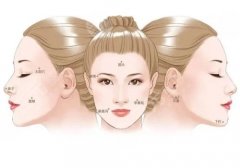北京世纪坛医院脂肪填充费用多少？5600元到45000元之间浮动，医生技术强，附价格表