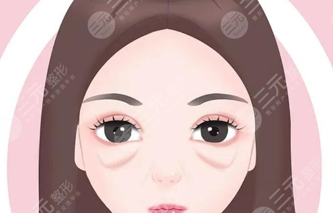 去眼袋