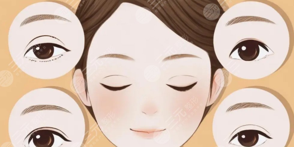 双眼皮