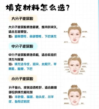 面部填充