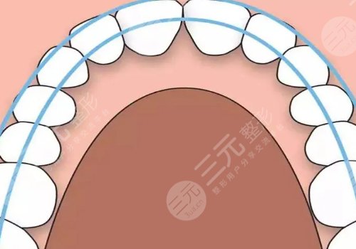 苏州正畸医生张秀乾怎么样