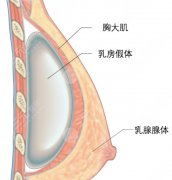 郑州隆胸费用多少钱?人气高的整形医院名单公布 郑州隆胸费用多少钱?人气高的整形医院名单公布