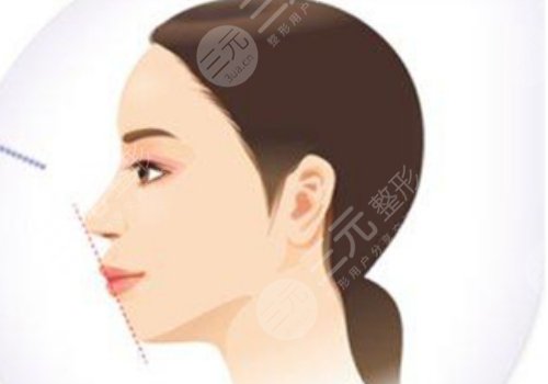 朴兴植是正颌界的佼佼者吗