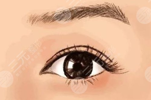 温科磊医生的双眼皮手术案例