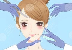成都画美的填充手术哪个医生好?多位操作严谨、审美在线 成都画美的填充手术哪个医生好?多位操作严谨、审美在线