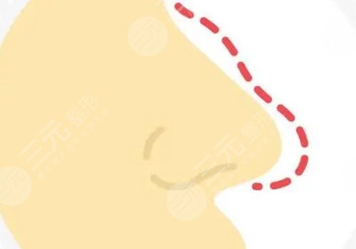 李信锋和李劲良选哪个