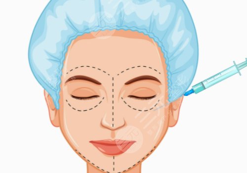 陈贞宜医生技术优势