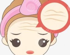 抬头纹填充的好还是打除皱?还有什么别的方法?科普知识汇总 抬头纹填充的好还是打除皱?还有什么别的方法?科普知识汇总