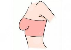 成都军大梁军医生做乳腺下垂手术怎么样?经验丰富、发挥稳定! 成都军大梁军医生做乳腺下垂手术怎么样?经验丰富、发挥稳定!