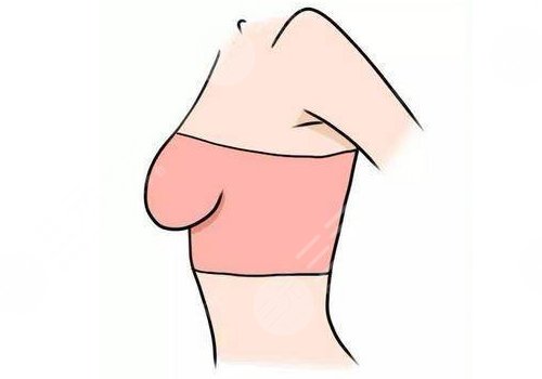 成都军大梁军医生做乳腺下垂手术怎么样