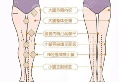 先直腿还是先瘦腿?哪种效果好?术后指南盘点 先直腿还是先瘦腿?哪种效果好?术后指南盘点
