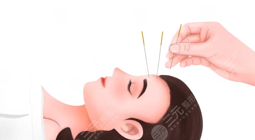 中医针灸能面部紧致提升