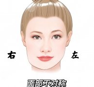 大小脸怎么改善？下面几种方式那种比较推荐呢？