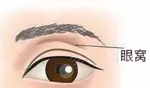 眼皮凹陷