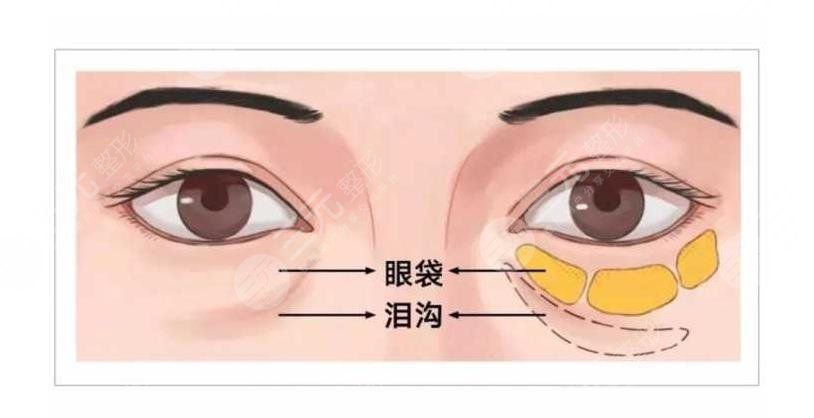 胶原蛋白VS玻尿酸