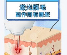激光VS冰点脱毛：谁才是毛躁克星？