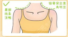 玻尿酸打造直角肩需要打几支？美人骨的科学与艺术~