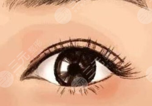 广医附一院双眼皮价格是多少