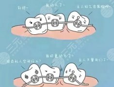 台州医院牙齿矫正多少钱?医院口碑评价|价目表一览! 台州医院牙齿矫正多少钱?医院口碑评价|价目表一览!