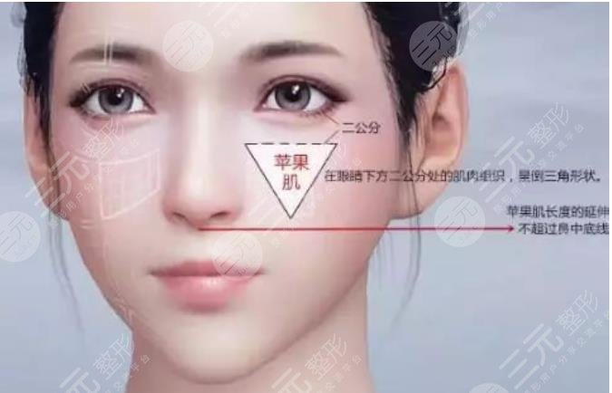 苹果肌