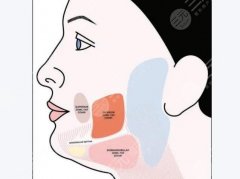 口角囊袋可以打溶脂吗？一篇说透“羊腮脸”拯救指南