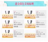 昆明黄金微针哪家医院做的好?昆医一附院等3家公立测评! 昆明黄金微针哪家医院做的好?昆医一附院等3家公立测评!