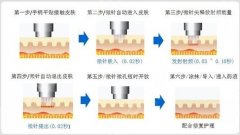 美迪迈黄金微针vs半岛黄金微针：抗衰界的“神仙打架”，你选哪款？