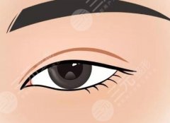 汕头双眼皮修复专家排名：寻找眼部重塑的希望之光