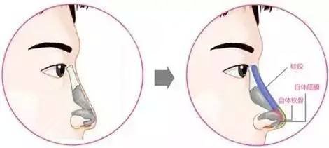 郑东蔚莱整形医院怎么样