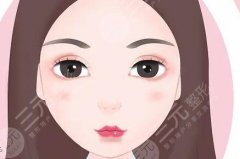 爱芙莱适合打嘟嘟唇吗？打之前这些事得知道