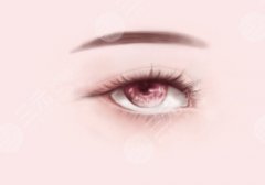 戚昌栋医生比较擅长做什么手术？双眼皮、吸脂都很拿手！人气很高！