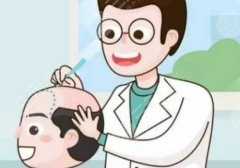 厦门重森植发怎么样?经验丰富、发挥稳定、案例较多! 厦门重森植发怎么样?经验丰富、发挥稳定、案例较多!