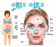 福州自体脂肪填充哪个医生做的好?郭国祥、陈小松等口碑TOP5测评 福州自体脂肪填充哪个医生做的好?郭国祥、陈小松等口碑TOP5测评