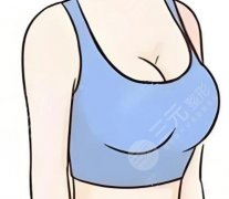 切副乳手术需要住院吗?住不住院全看这2点,很多人白担心了 切副乳手术需要住院吗?住不住院全看这2点,很多人白担心了