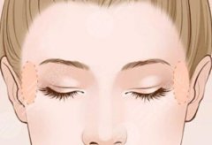 纠结欧洲之星紧致还是3D生物?普通人看完不踩坑的医美干货 纠结欧洲之星紧致还是3D生物?普通人看完不踩坑的医美干货